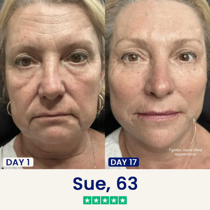 The Liftology™ Lift