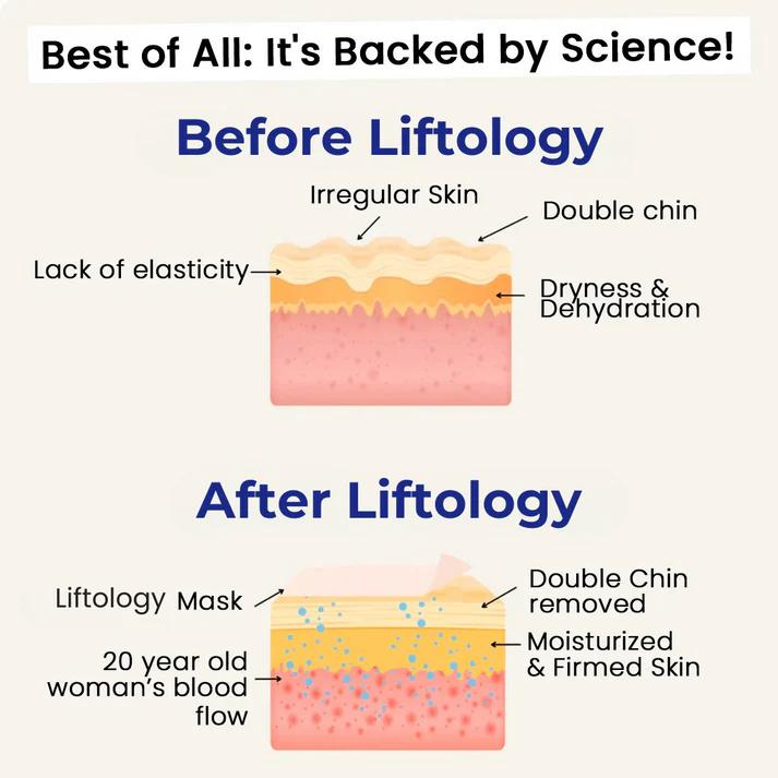 The Liftology™ Lift